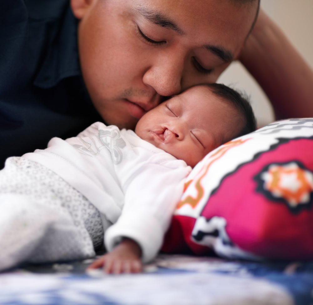 Imagem de um pai beijando o rostinho do seu bebê. A criança usando uma roupinha branca está deitada na cama com a cabeça em um travesseiro e possui um pequena fissura labial. A foto faz alusão ao tema lábio leporino