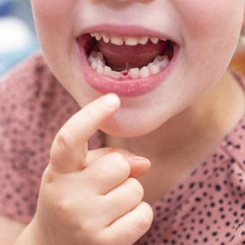 Uma criança com a boca aberta aponta para um dente de leite que caiu.