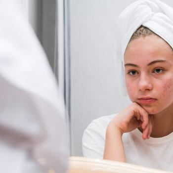 Menina branca, adolescente, se olha no espelho. Ela está com toalha de banho na cabeça, camiseta branca e tem marcas de acne espalhadas pelo rosto.