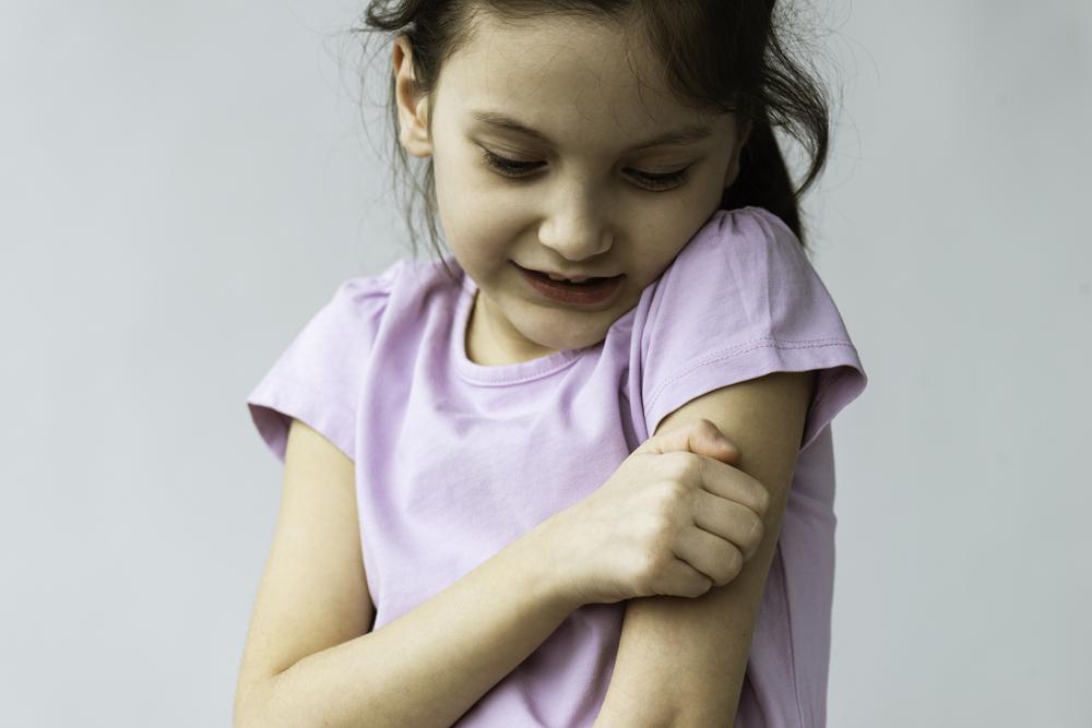 Imagem de uma criança coçando o próprio braço, a coceira pode ser um dos sintomas de alergia emocional.